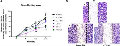 Crotoxin Inhibits Endothelial Cell Functions in Two- and Three-dimensional Tumor Microenvironment